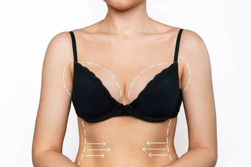 Breast Augmentation and Breast Implant Turkey Breast Augmentation and Breast Implant Turkey