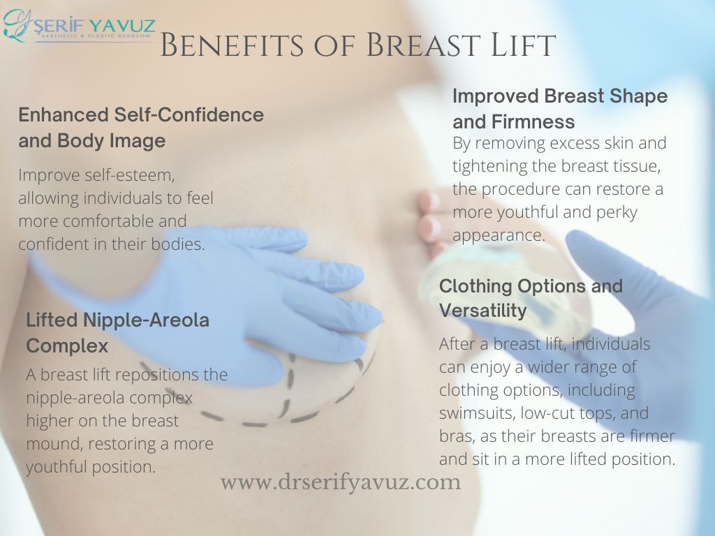 Benefits of Breast Lift Benefits of Breast Lift